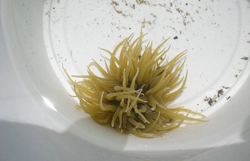 Zehirli Yosun Tedavisi Nasıl Yapılır?